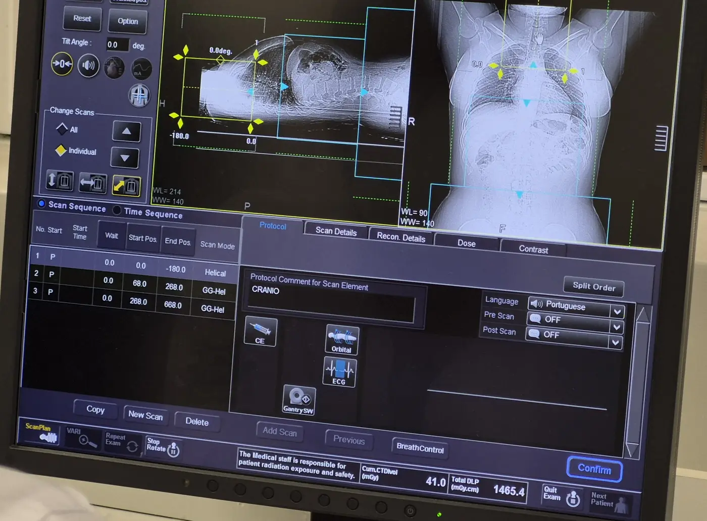 Inauguração Centro de Imagem do Hospital Universitário e Universidade Federal do Amapá