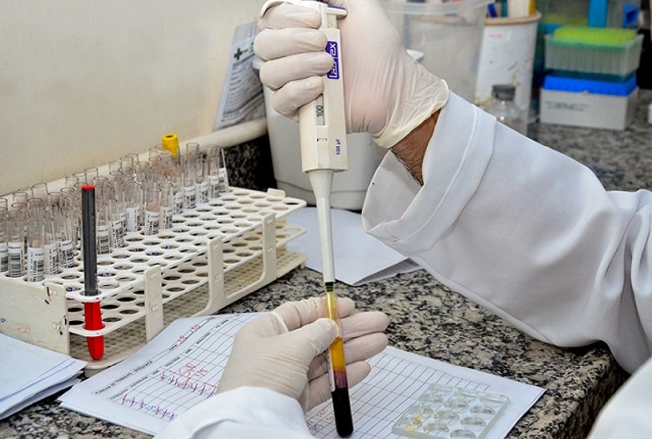 Os testes de carga viral são fundamentais para o acompanhamento de pacientes com HIV/Aids em tratamento, e devem ser feitos a cada três meses.