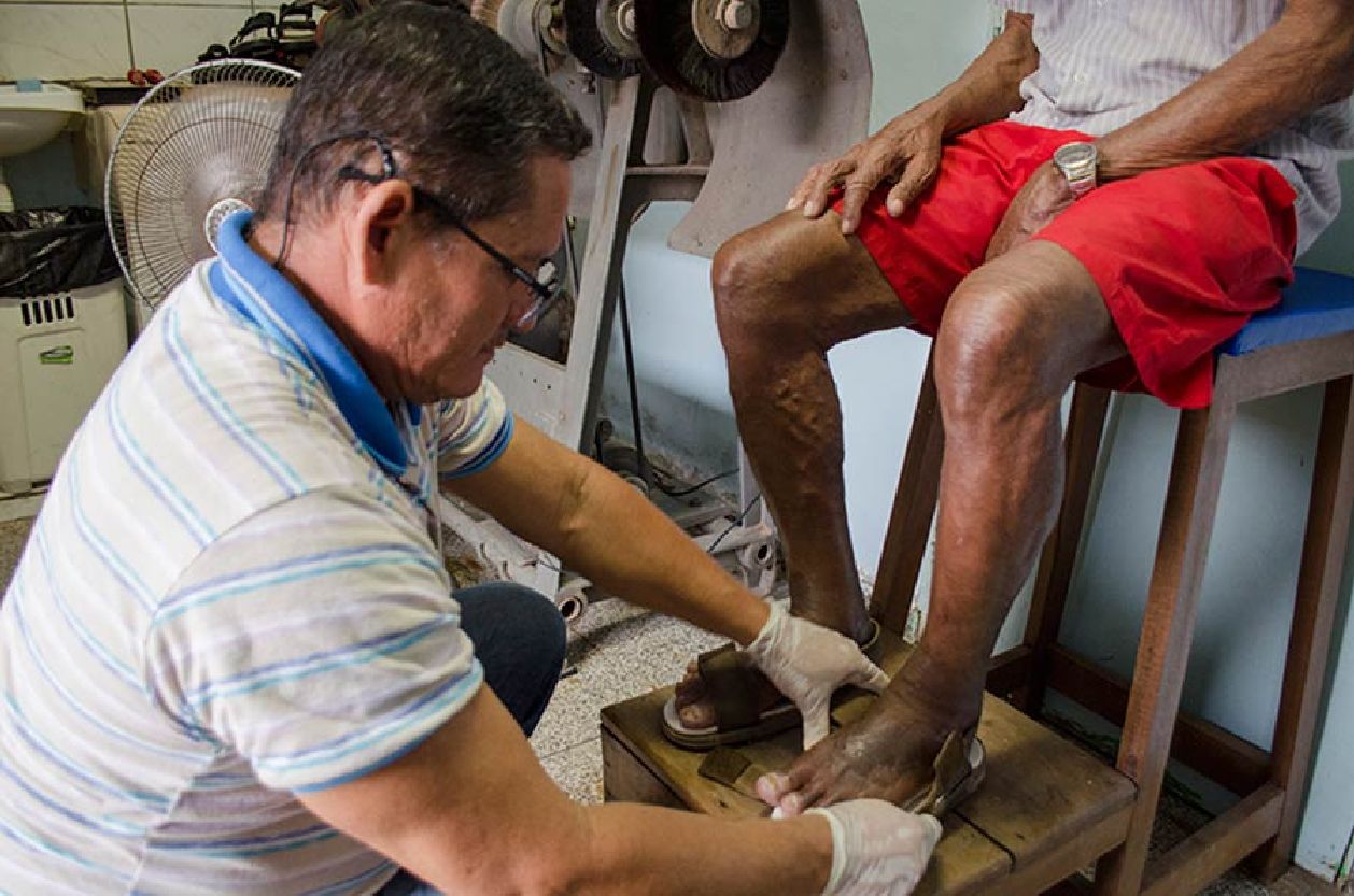 Palmilhas são adaptadas no próprio Centro, de acordo com a necessidade de cada paciente