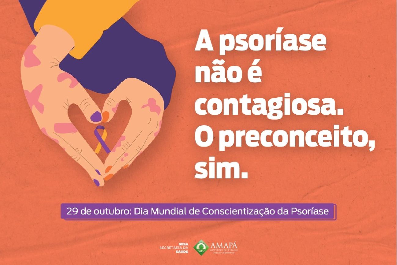 Dados da Sociedade Brasileira de Dermatologia (SBD) apontam que a patologia afeta 2 milhões de pessoas no Brasil.
