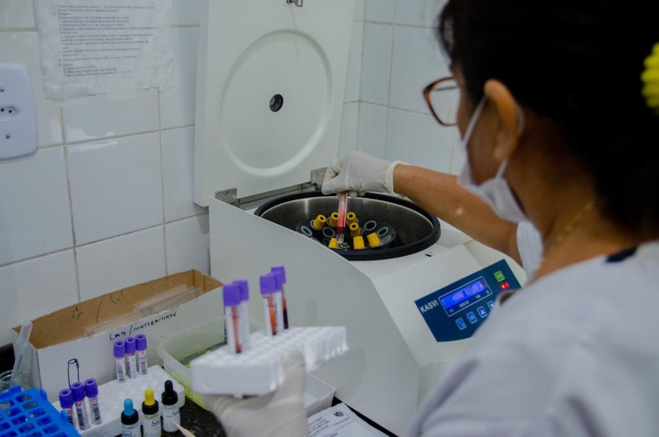 Principais demandas são de exames de bioquímica, hematologia, testes rápidos, coagulograma e urinálise