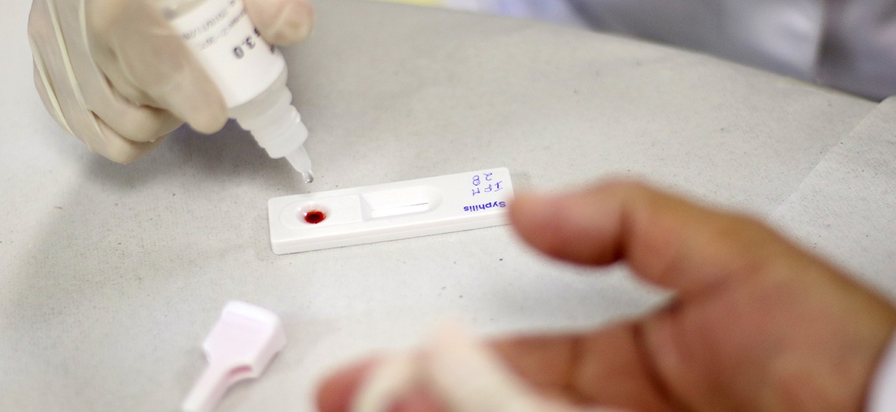 Teste rápido para detectar sífilis está disponível nas Unidades Básicas de Saúde