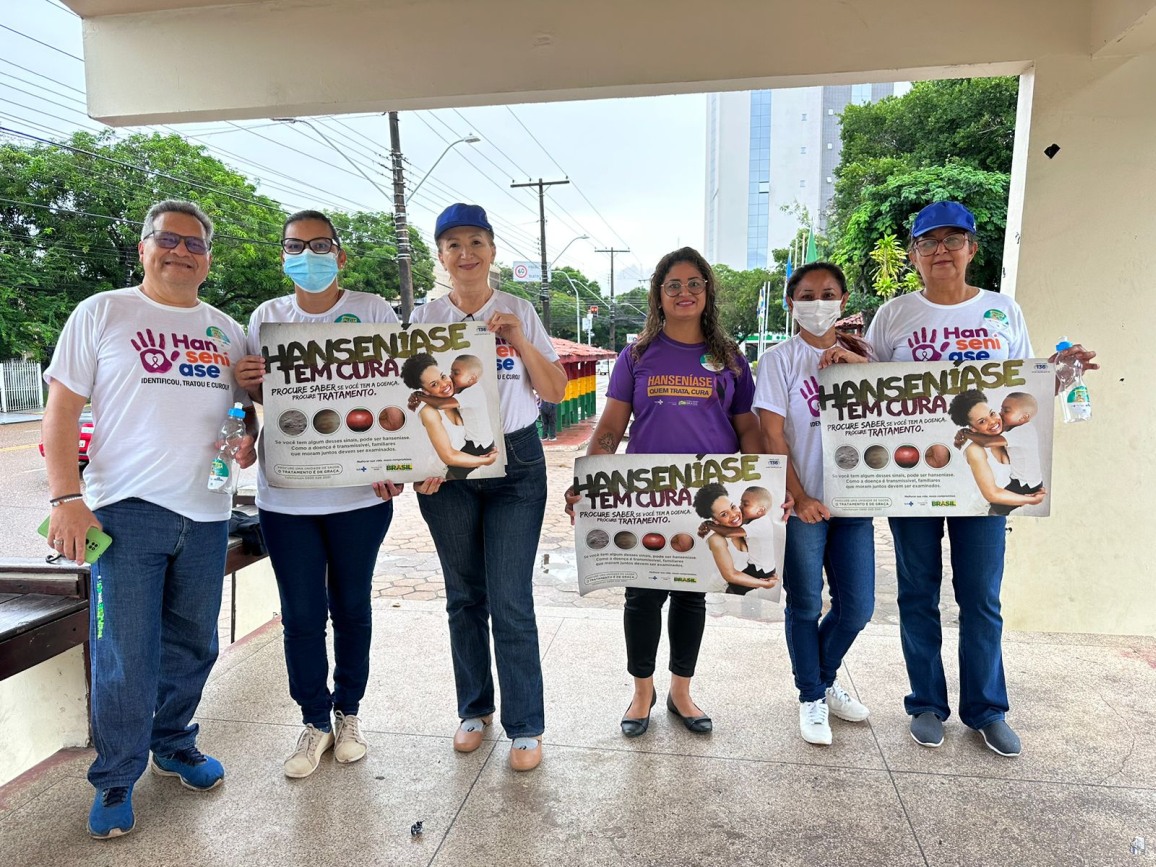 Em 2022, 58 pessoas foram confirmadas com hanseníase no Amapá.