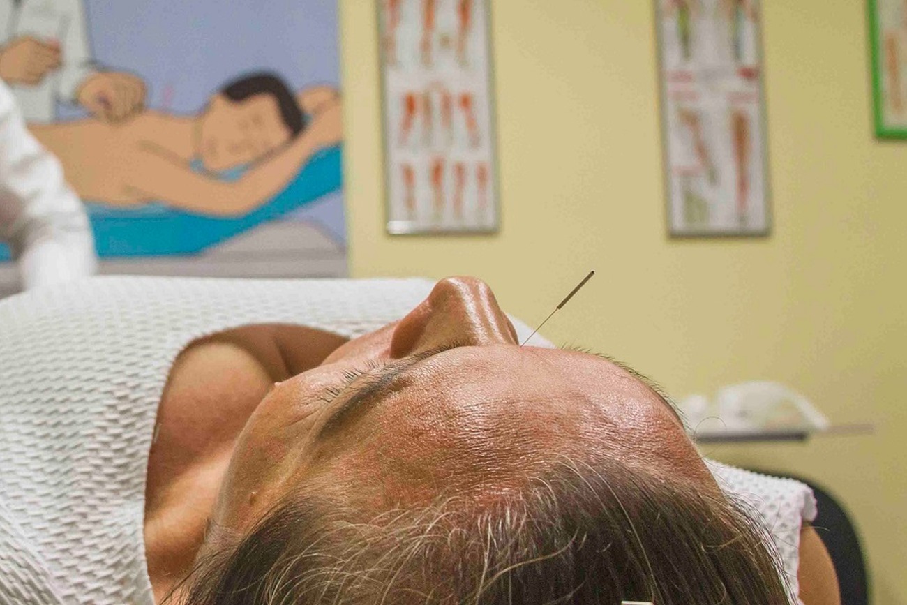 Acupuntura usa a aplicação de agulhas nas musculaturas para aliviar a tensão