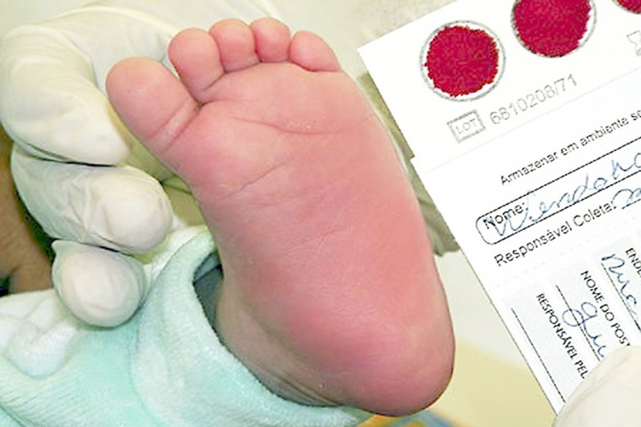 O exame, que é realizado a partir de uma gota de sangue, é praticamente indolor