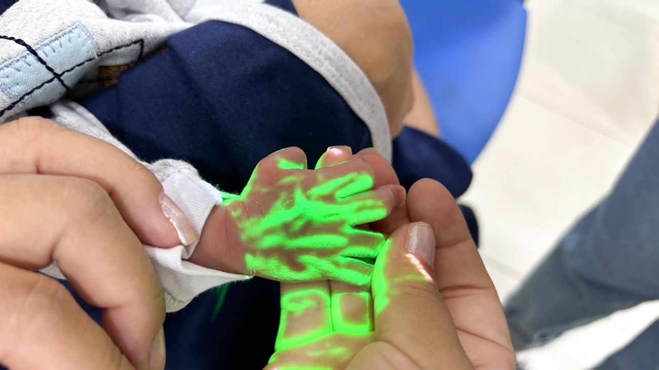 Venoscópio destaca as veias em cores
