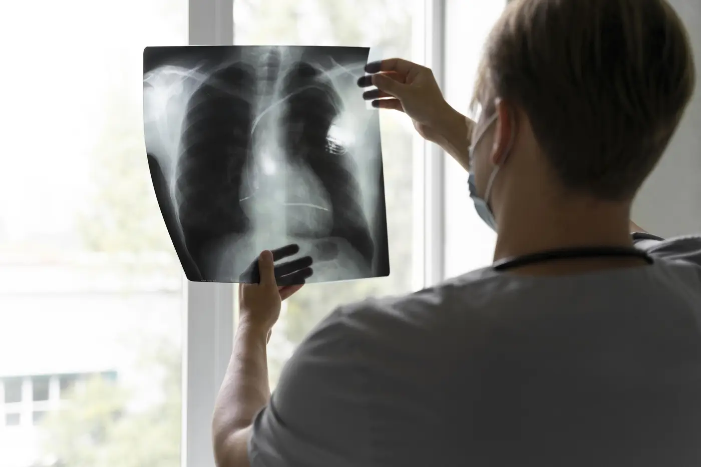 Atualmente, o CRDT faz o tratamento de 49 pacientes diagnosticados com tuberculose em Macapá