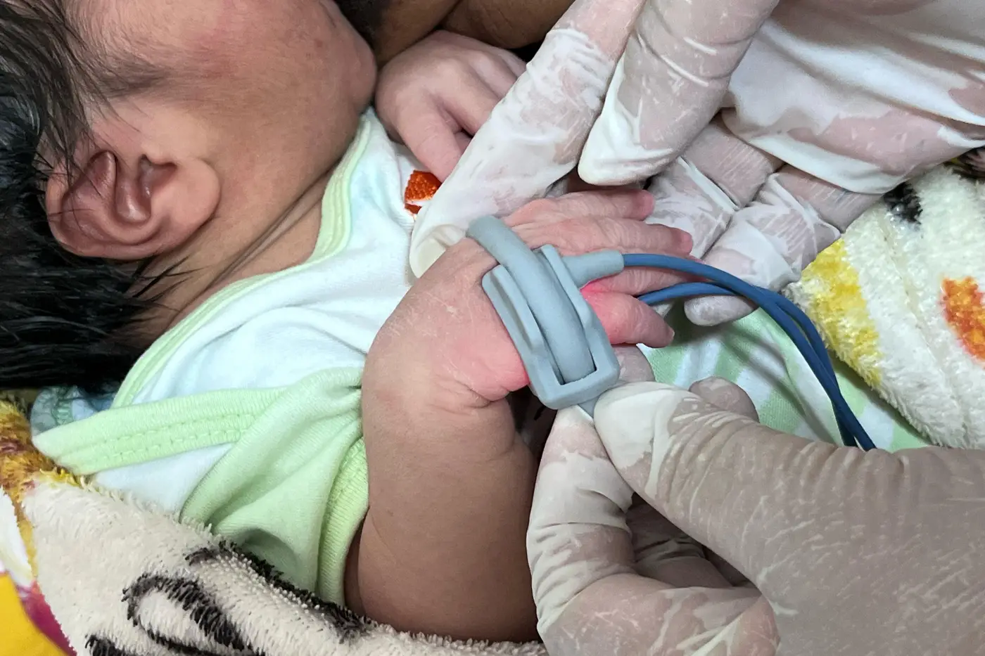 Maternidade do Hospital da Mulher Mãe Luzia passou a realizar o teste do coraçãozinho na triagem neonatal