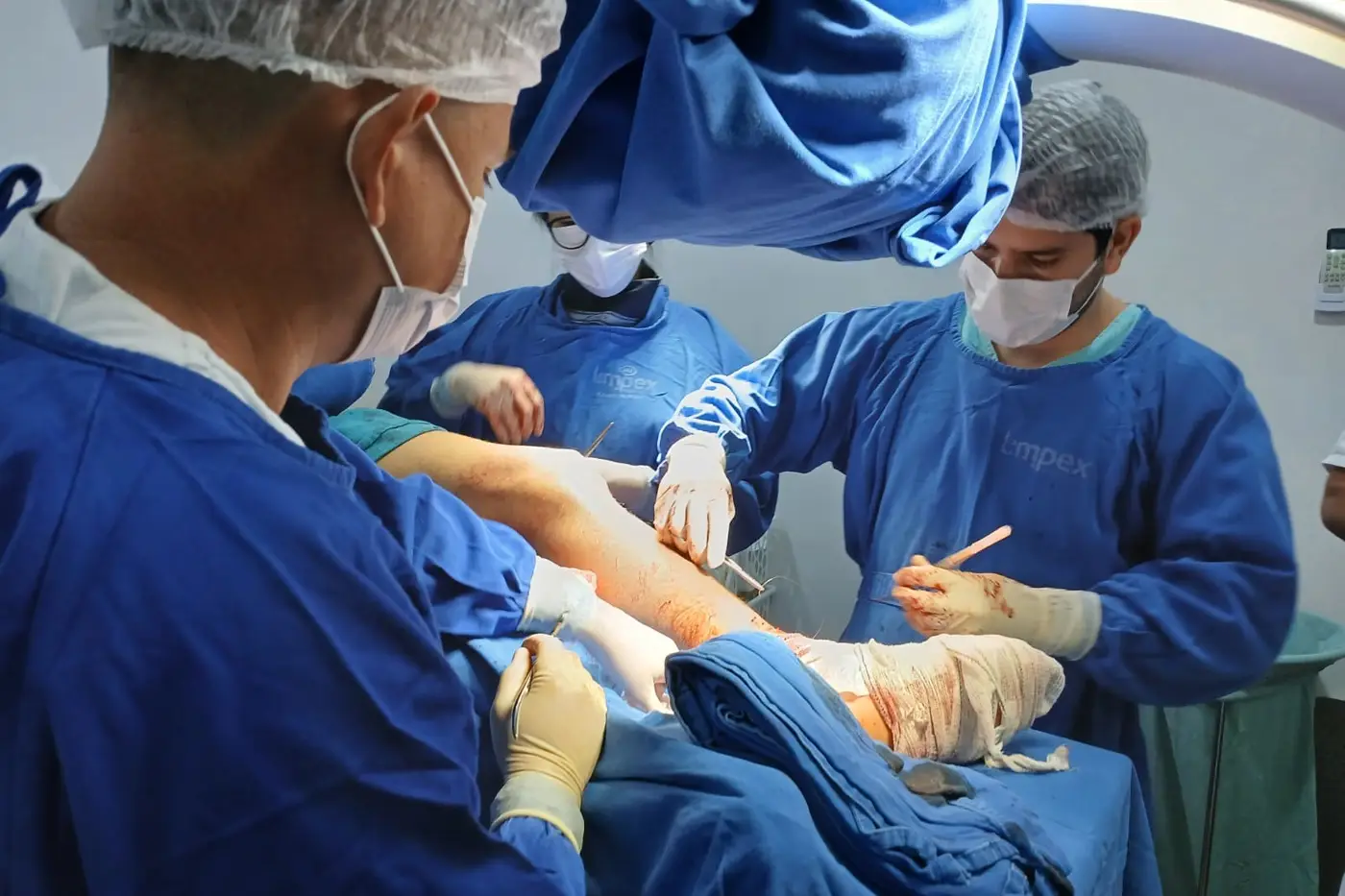 Ortopedista Luiz Fernando e equipe durante cirurgia complexa no Hospital Estadual de Laranjal do Jari