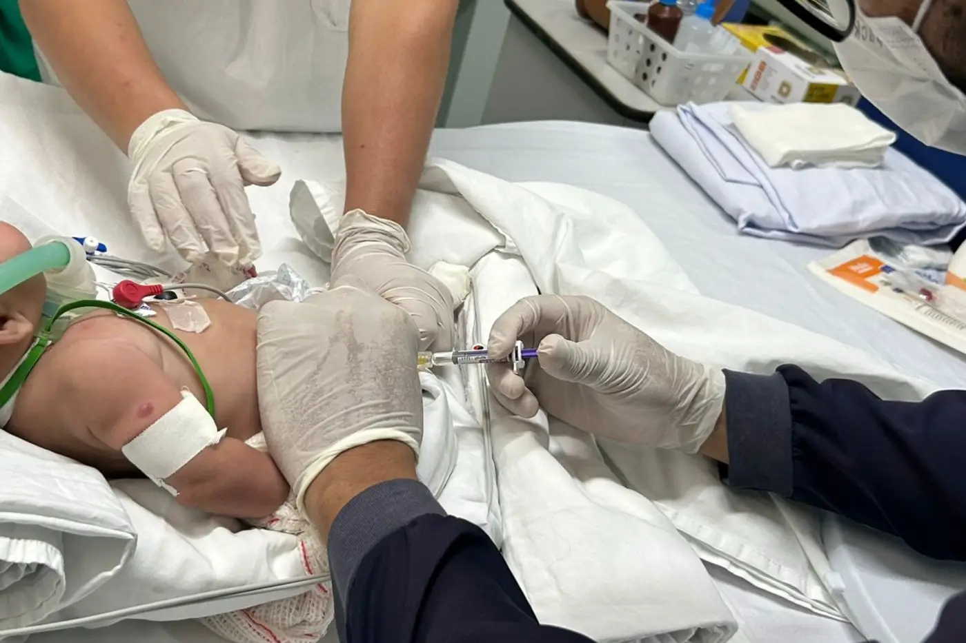 Nirsevimabe é um medicamento utilizado na prevenção de complicações respiratórias graves em bebês, especialmente contra o Vírus Sincicial Respiratório (VSR)
