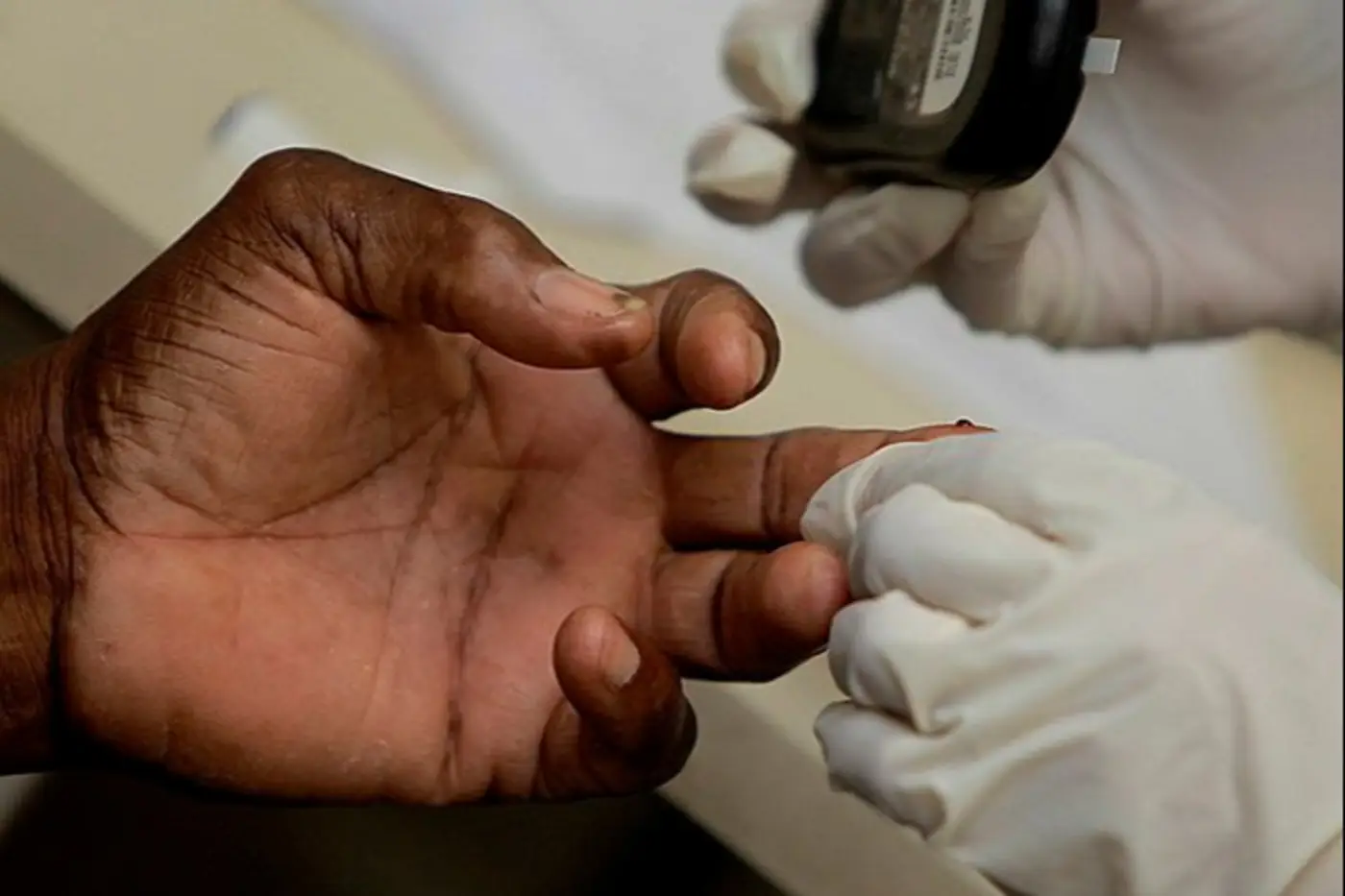 Governo do Amapá alerta para a prevenção e oferece tratamento integral na rede pública para o diabetes