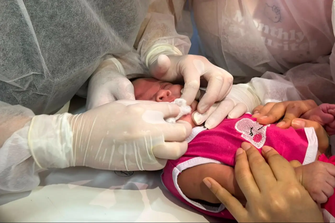 Na Vila Progresso, uma bebê foi beneficiada com uma frenotomia lingual, procedimento realizado para corrigir a anquiloglossia, conhecida popularmente como "linguinha presa"