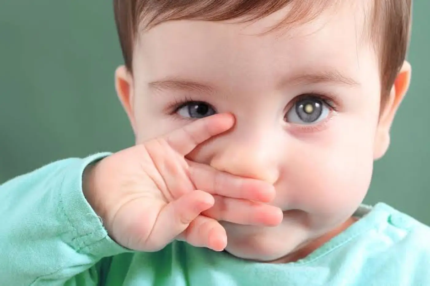 Pais e responsáveis devem ficar atentos a alterações nos olhos dos bebês e buscar avaliação oftalmológica diante de qualquer sinal diferente